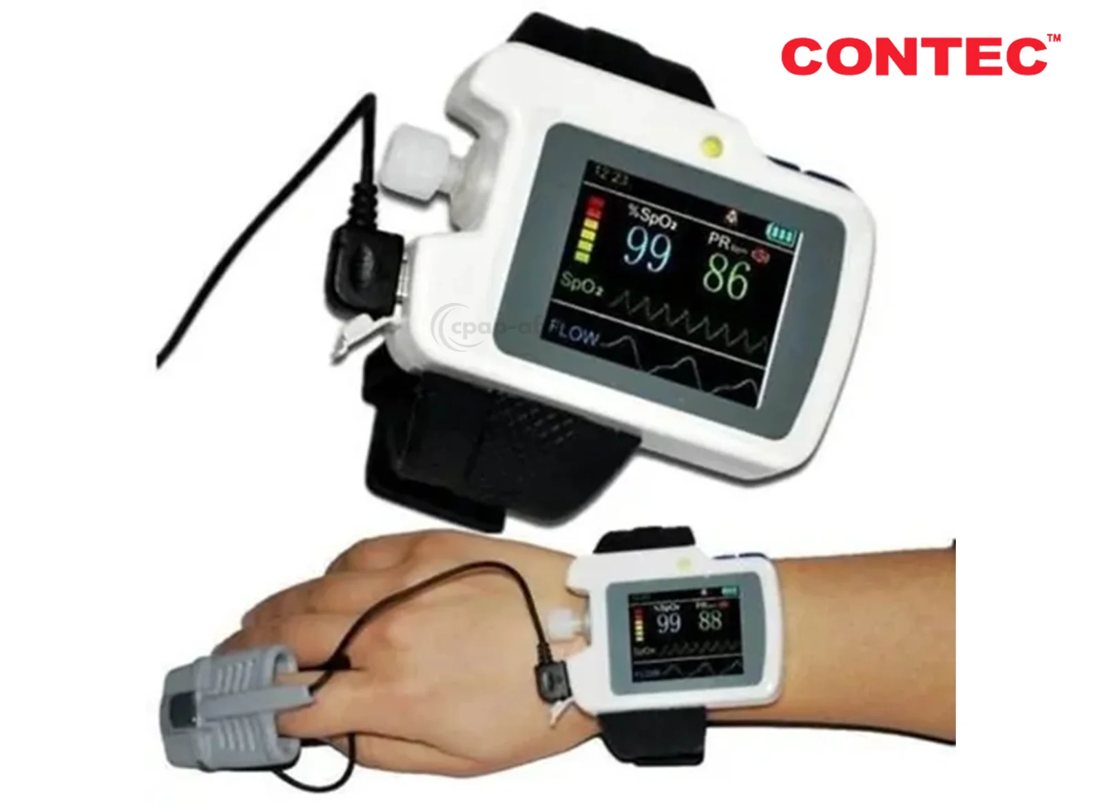 CONTEC RS01 Sleep Apnea Screen Meter